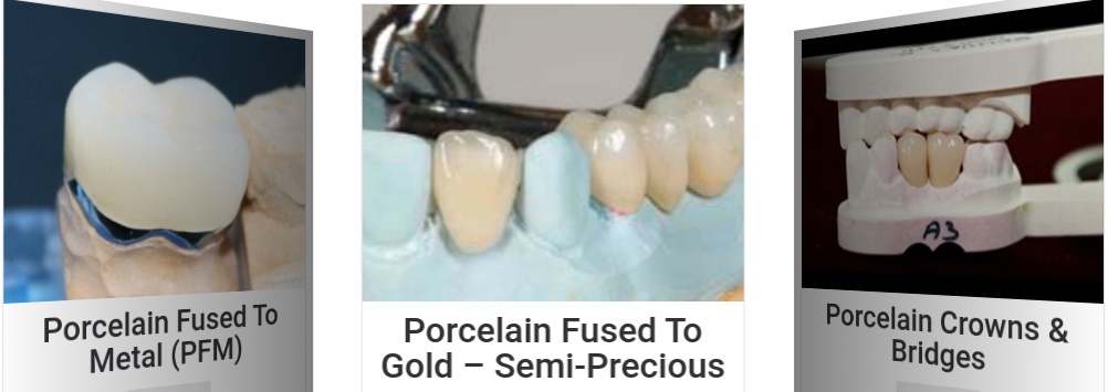 What Perks Do You Get With Porcelain Dental Crown?