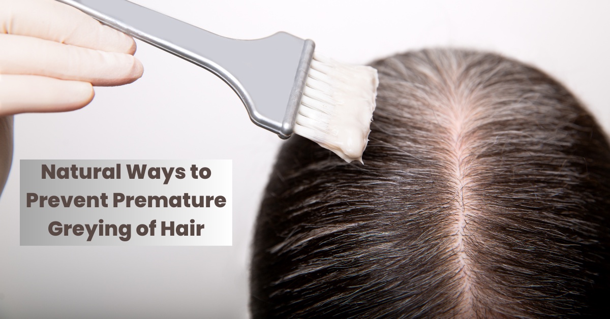 Natural Ways to Prevent Premature Greying of Hair