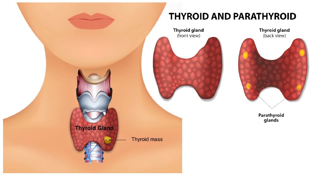 Thyroid Problems & Disease – Types and Causes