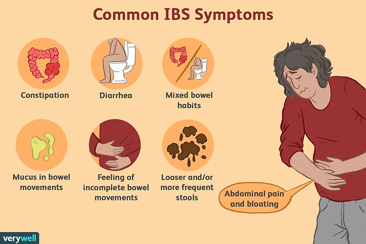 IBS Hypnosis: A Natural Approach to Relieving Symptoms