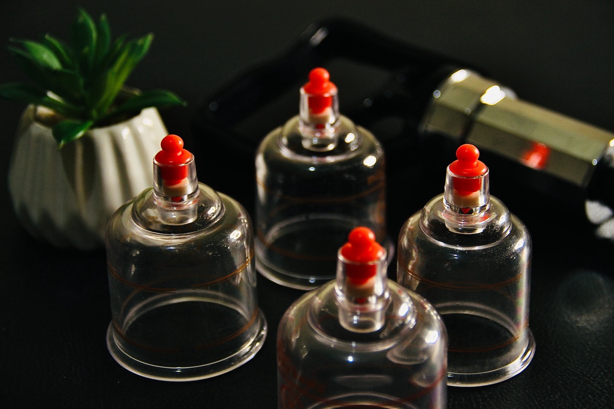 Suctioned Serenity: Harnessing Health Benefits Through Cupping Therapy