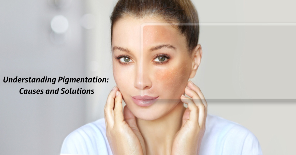 Understanding Pigmentation: Causes and Solutions