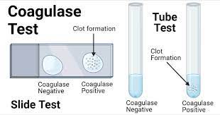 Coagulase Test- Its Principle, Procedure, Types and Interpretation