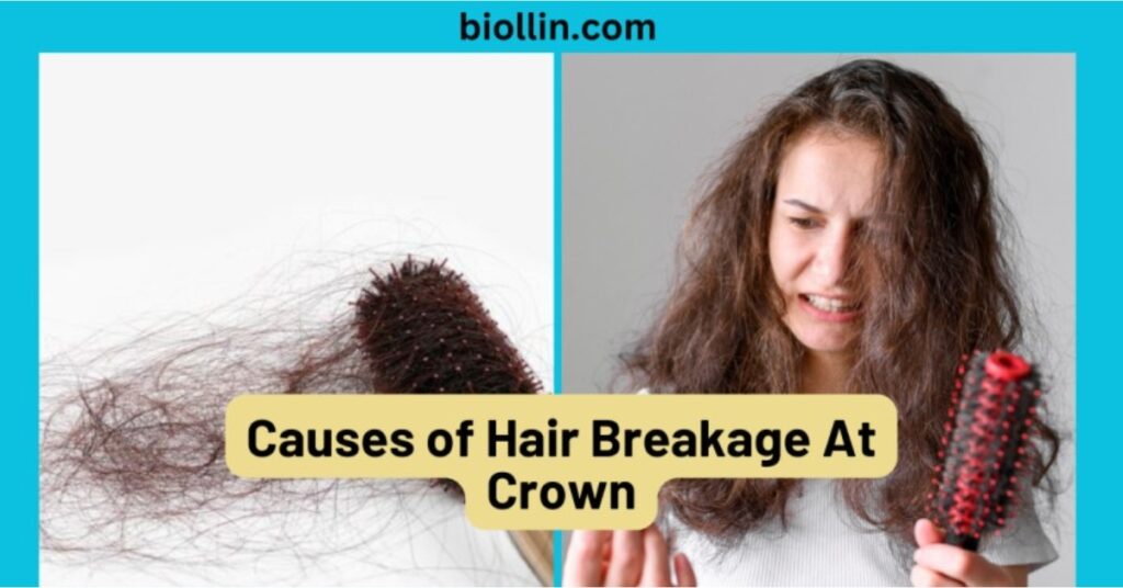 Causes of Hair Breakage At Crown