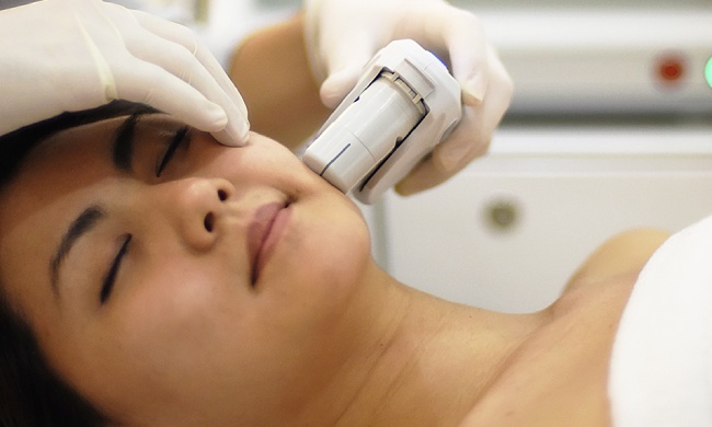 Non-Surgical Facelift: Is Ultherapy Right for You ?