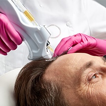 The Future of Hair Restoration: What Lies Ahead