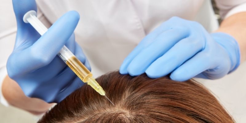 Transform Your Hair with PRP: The Ultimate Guide