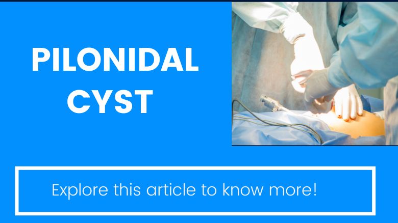 How does the best doctor treat pilonidal cyst?