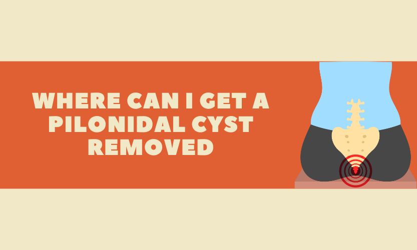 Which doctor treats pilonidal cyst