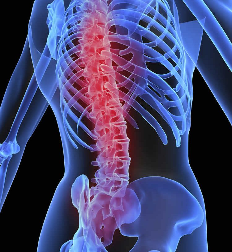 What is a Spinal Cord Injury and Its Causes?