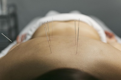Acupuncture Treatment: How does acupuncture work?