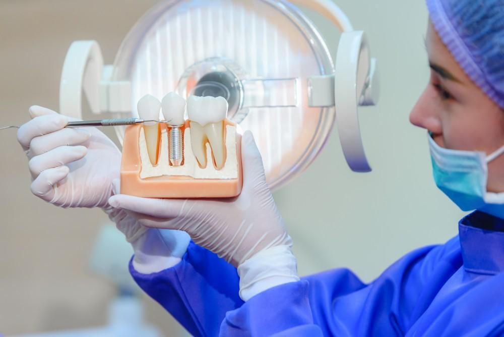 Enhancing Lives: The Impact of Modern Dental Implants