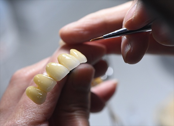 Revolutionizing Dentistry: The Cutting-Edge Solutions of China Digital Dental Labs