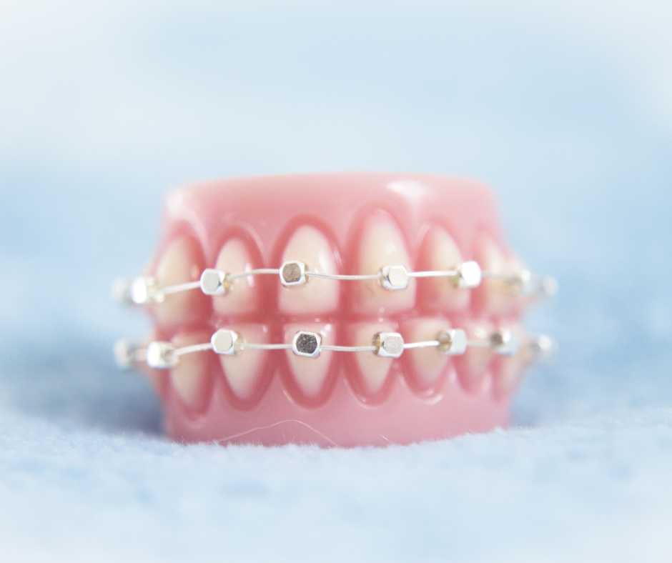 Straighten Up and Smile! Understanding Orthodontics for All Ages