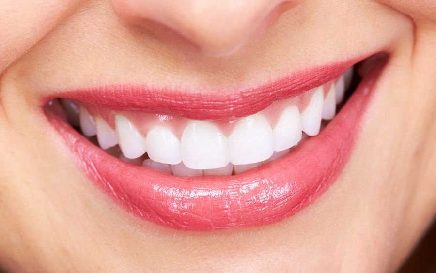 Beyond Aesthetics: The Psychological Impact of a Hollywood Smile