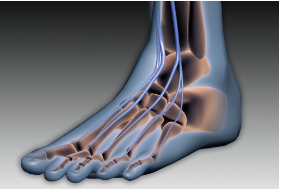 Exploring Neuropathy Relief: The Rebuilder 300 and Innovative Rebuilder Technology