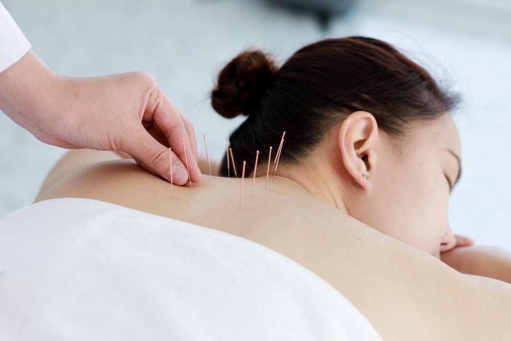 Exploring Electro-Acupuncture: What It Is and How It Can Enhance Your Well-Being