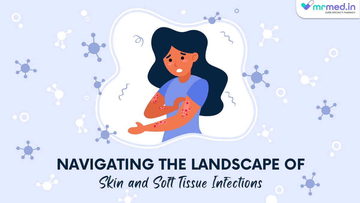 Navigating the Landscape of Skin and Soft Tissue Infections