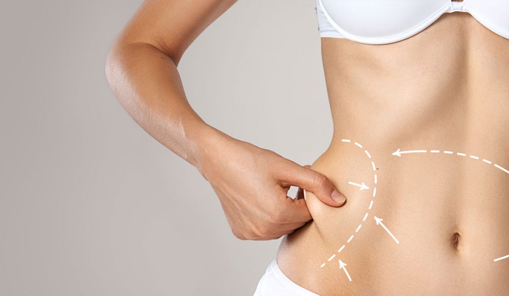 Liposuction RecoveryTips for a Smooth Healing Process By Royal Clinic Riyadh