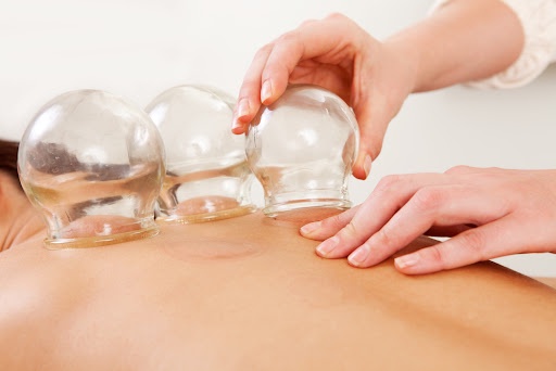 The Ultimate Guide to Hijama Therapy: Dubai's Answer to Holistic Health