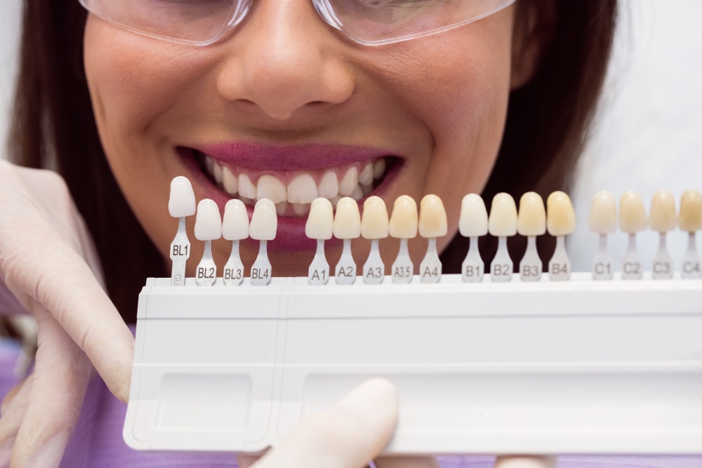 How Do Dental Veneers Compare to Other Cosmetic Options?