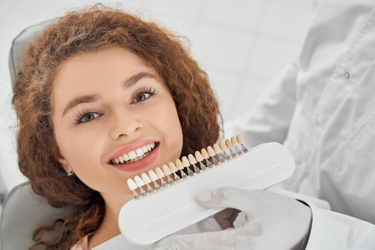 What Are the Steps Involved in Getting Veneers?
