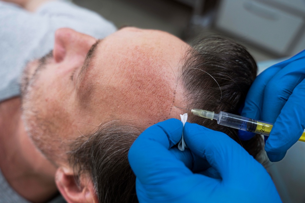 Which is The Better Hair Restoration Laser Cap, iRestore or Capillus?