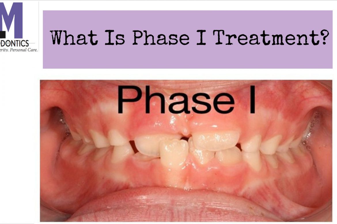 Phase 1 vs. Phase 2 Orthodontic Treatment: What's the Difference?
