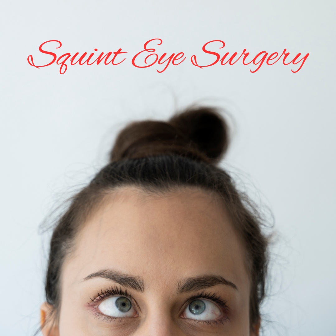 All About Squint Eye Surgery - Benefits and Planning