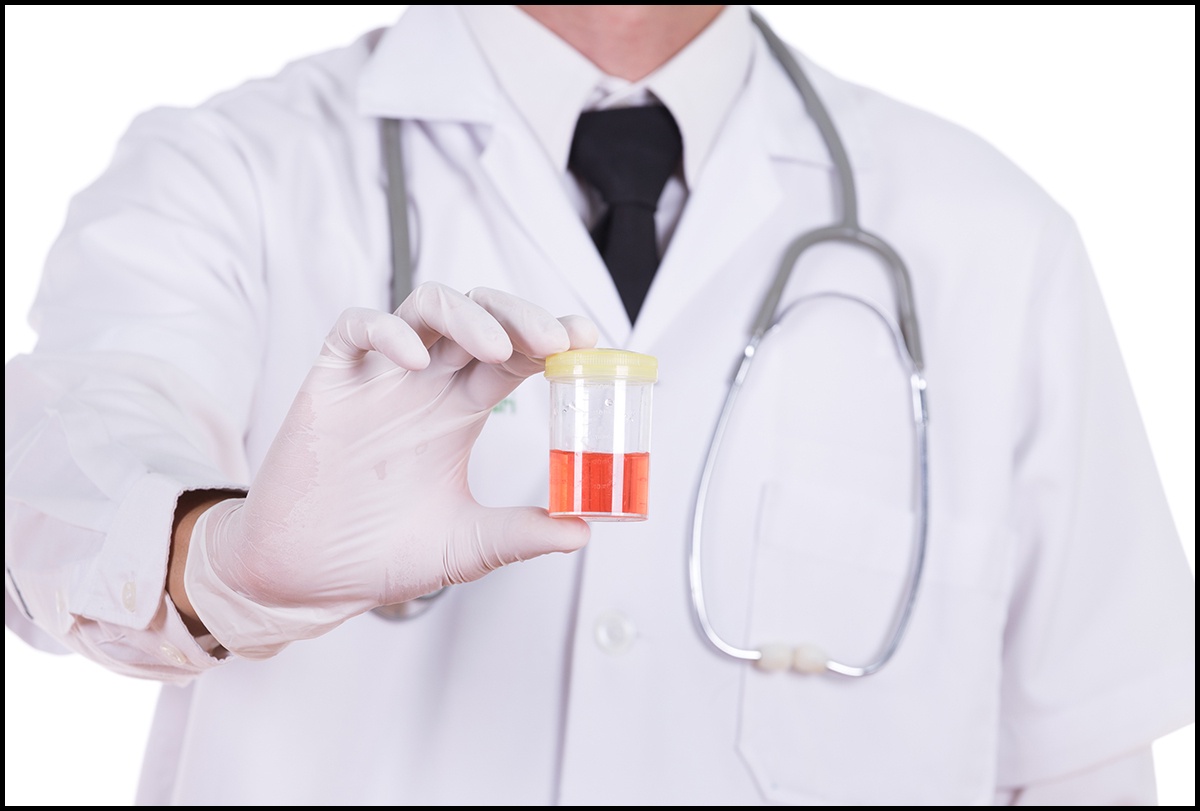 Blood in Urine: Can It Resolve Itself Naturally?