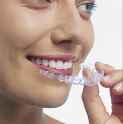 The Power of Invisalign Clear Aligners