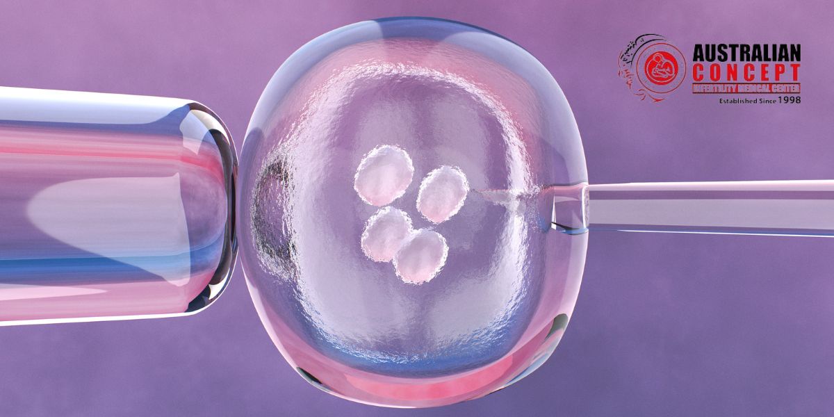 What to Know About in Vitro Fertilization (IVF)