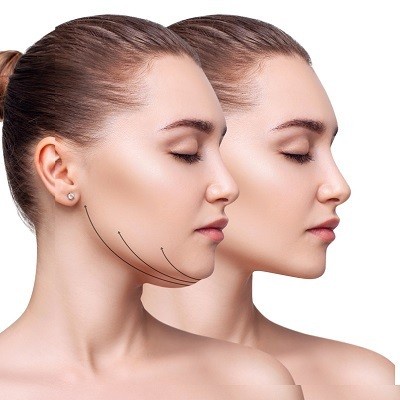 Eliminating Double Chin Woes: Effective Solutions in Islamabad