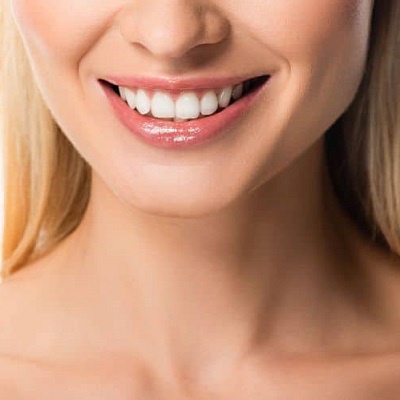 Get Ready to Shine: Teeth Whitening Solutions in Islamabad