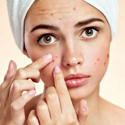 Why All the Fuss About Acne Treatment in Dubai?