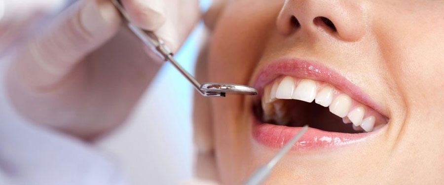 Teeth Cleaning or Teeth Whitening? Which is Your Choice?
