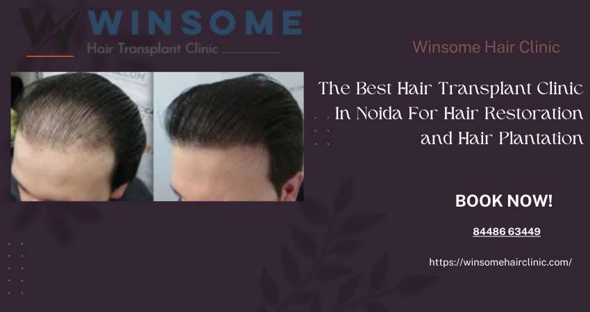 The Best Hair Transplant Clinic In Noida For Hair Restoration and Hair Plantation