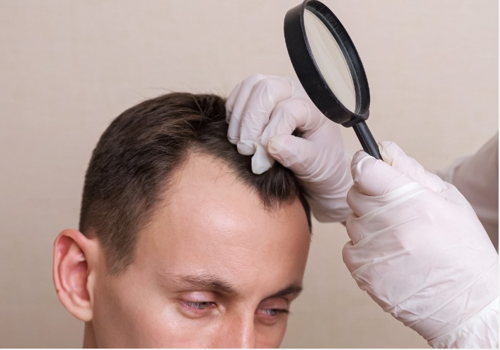 What Can You Expect During The Hair Stem Cell Transplantation Procedure?