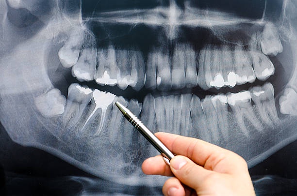 A Comprehension to Dental X-Rays Services: A Pathway to Better Oral Health