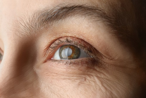 Understanding Common Eye Conditions: Causes, Symptoms, and Treatment Options
