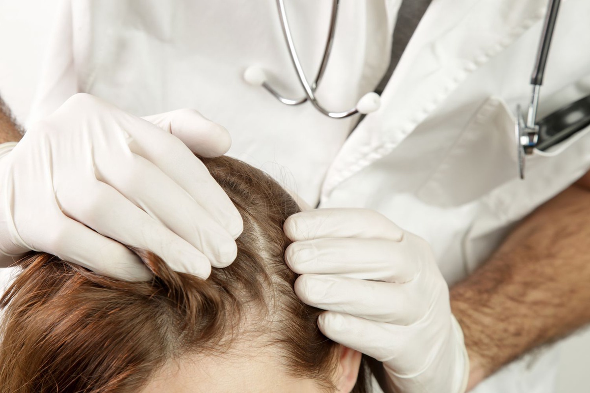 How Long Does It Take to See Results After a Hair Implant Procedure?