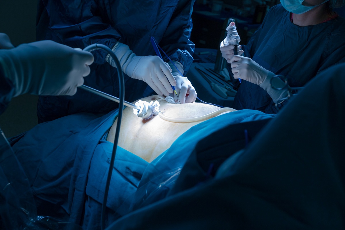 What Are Some Common Conditions Treated with Laparoscopic Surgery?