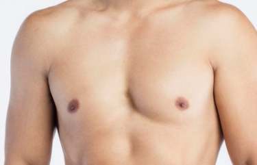 Recovery Process After Gynecomastia Surgery