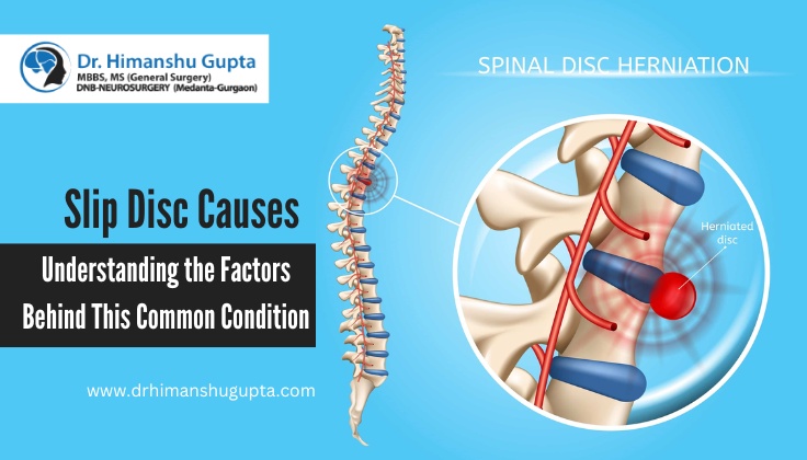 Spinal Fixation Causes: A Closer Look at Risk Factors and Solutions
