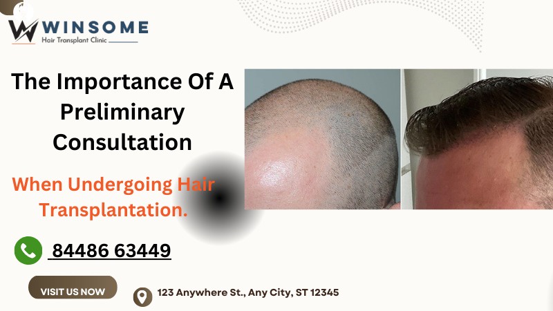 The Importance Of A Preliminary Consultation When Undergoing Hair Transplantation.