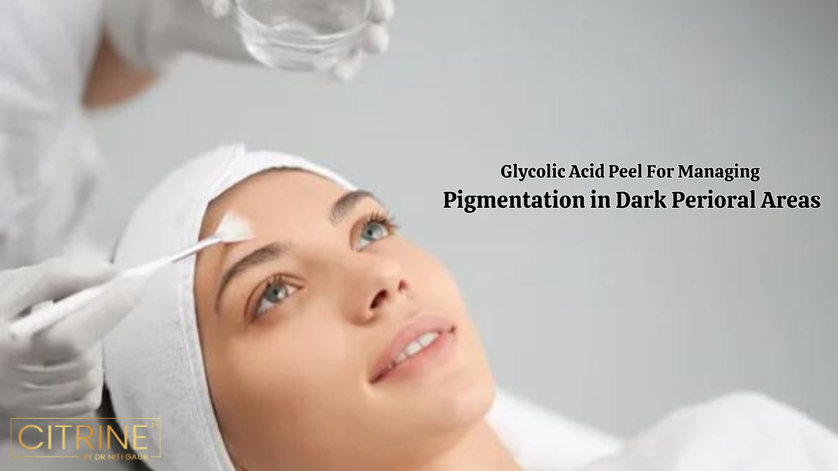 Glycolic Acid Peel For Managing Pigmentation In Dark Perioral Areas