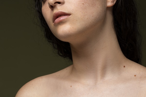 Skin Tags: Causes, Prevention, and Skin tag removal Options in Singapore