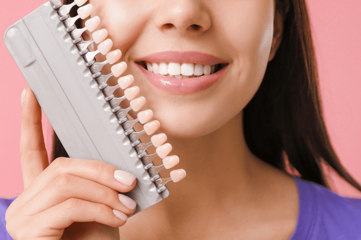 Why Dental Veneers Are the Perfect Solution for Crooked Teeth
