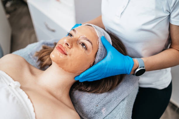 The Role of Aestheticians in Chemical Peel Treatments