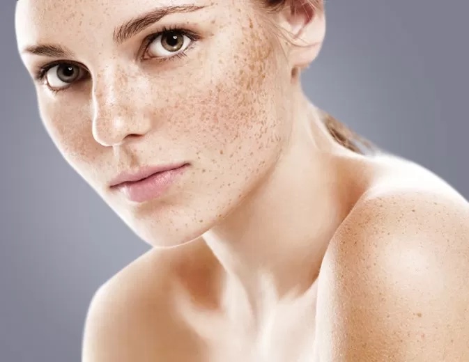 Transform Your Skin: Pigmentation Treatment in Dubai Explained